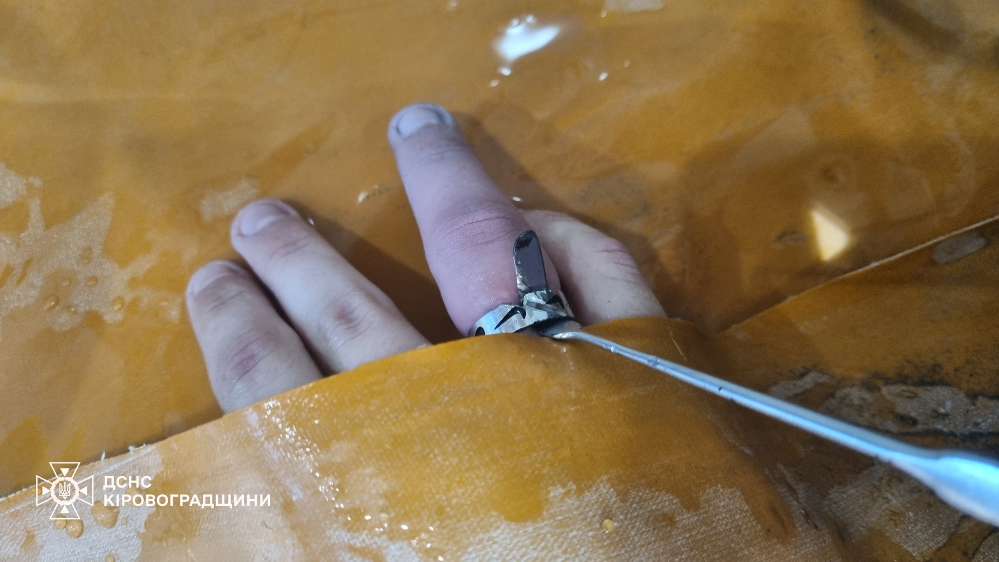 23 травня підрозділ ДСНС допоміг підлітку в Олександрії зняти каблучку з пальця.
