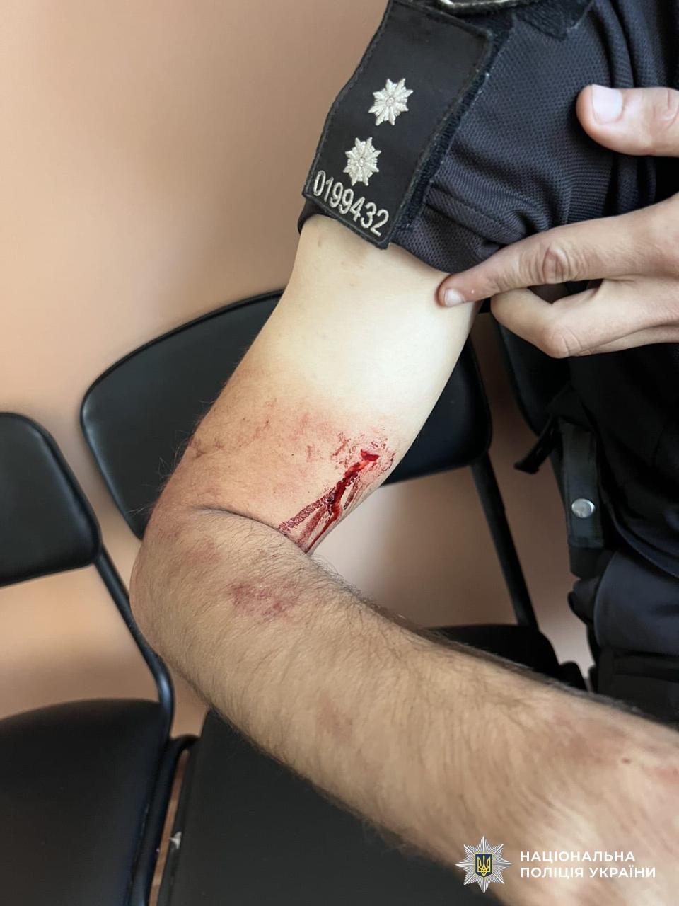На Кіровоградщині затримали чоловіка, який стріляв у правоохоронців