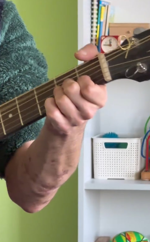 У міській лікарні в Олександрії оновили реабілітаційне відділення